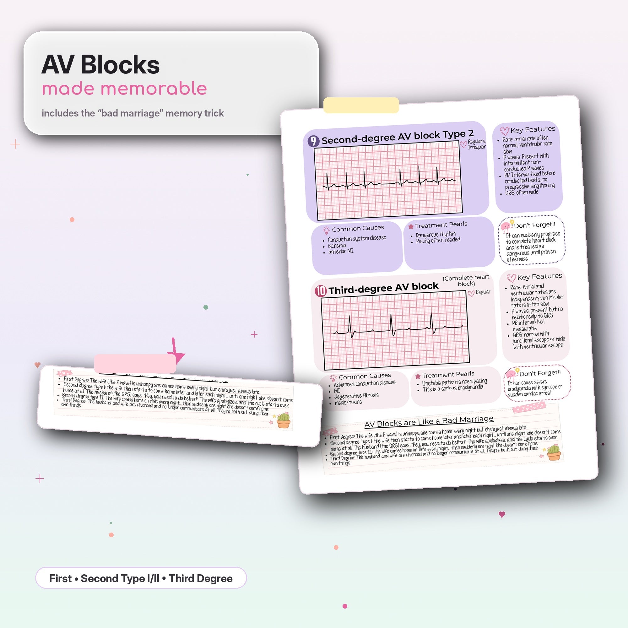 AV blocks memory trick page from EKG study guide